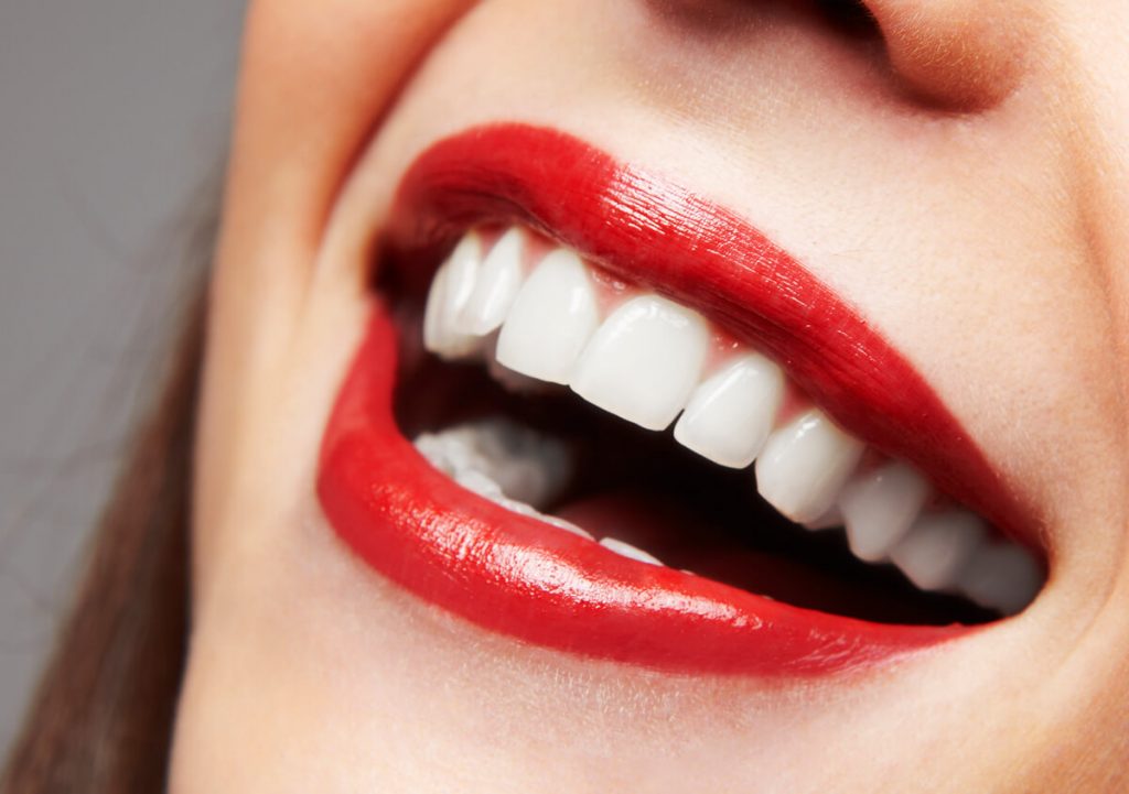 Dental Veneers Knoxville TN