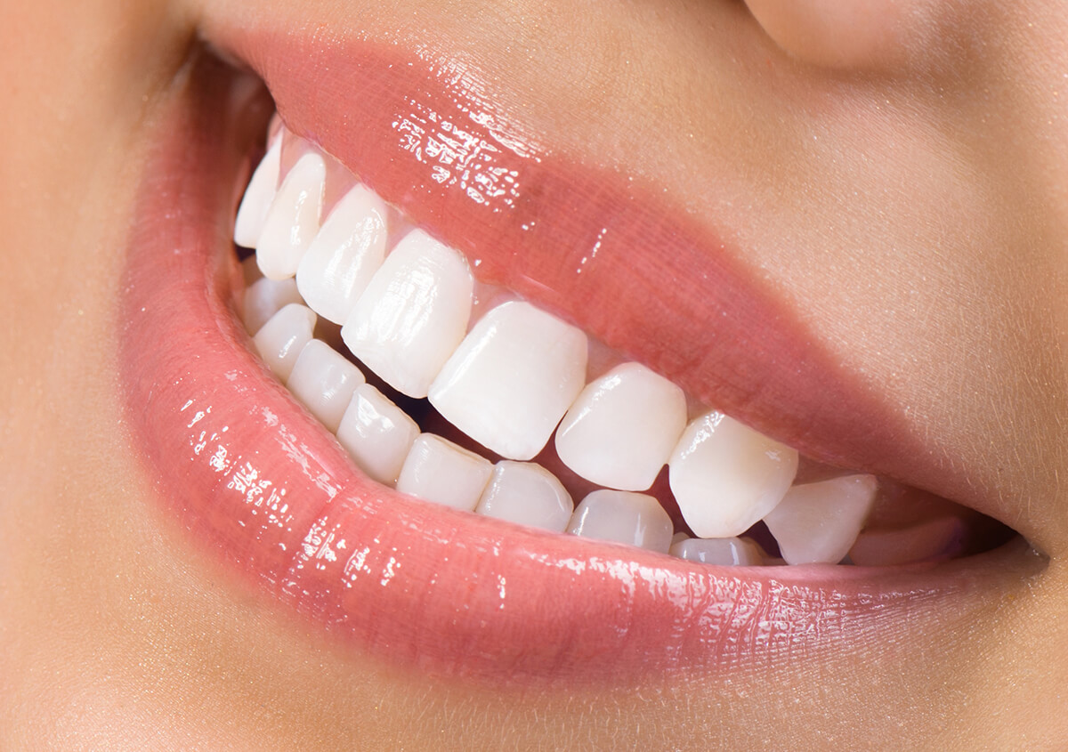 Teeth Whitening Service in Knoxville TN Area