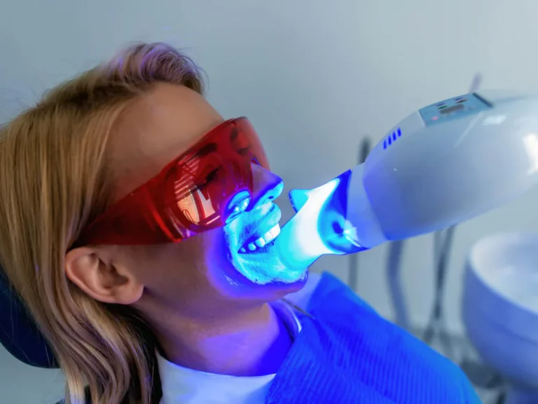 Teeth Whitening Services available at South Knox Dental in Knoxville, TN